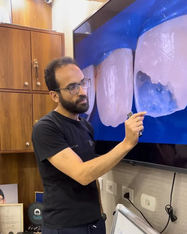 Anterior & posterior composite