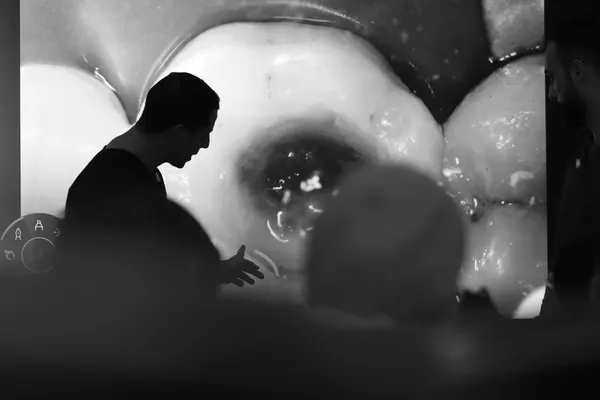 Anterior & posterior composite