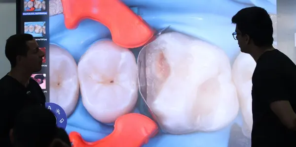 Anterior & posterior composite