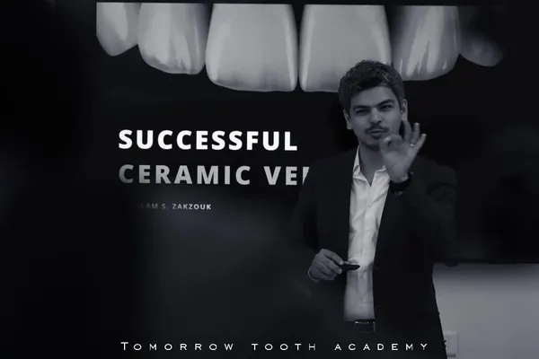 Successful ceramic veneers
