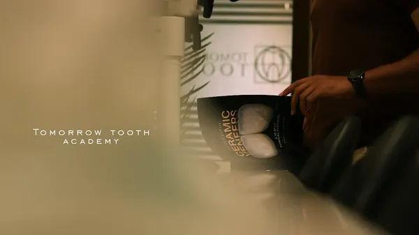 Successful ceramic veneers