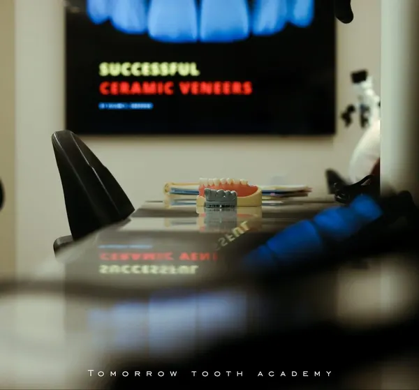 Successful ceramic veneers