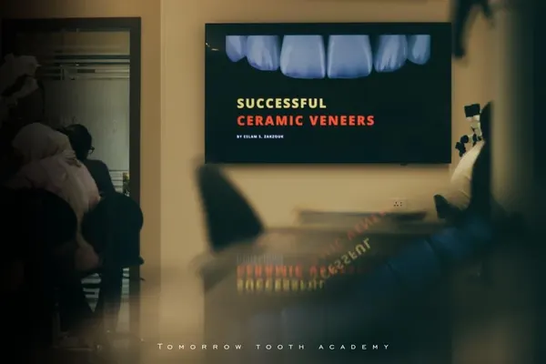 Successful ceramic veneers